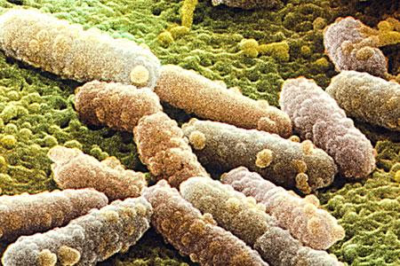 E. coli merupakan bakteri berbentuk batang dengan panjang sekitar 2 micrometer dan diamater 0.5 micrometer. Banyak industri kimia mengaplikasikan teknologi fermentasi yang memanfaatkan E. coli. Misalnya dalam produksi obat-obatan (insulin, antiobiotik), high value chemicals (1-3 propanediol, lactate). Secara teoritis, ribuan jenis produk kimia bisa dihasilkan oleh bakteri ini asal genetikanya sudah direkayasa sedemikian rupa guna menghasilkan jenis produk tertentu yang diinginkan. 