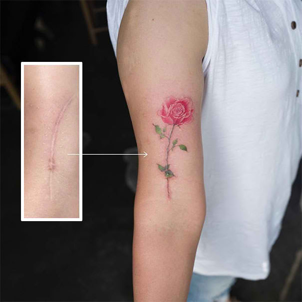 LOOK: Tattoo Artists Create A Masterpiece By Covering Up These Huge Scars With A Stunning Tattoo!