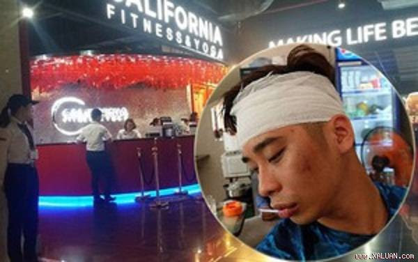  California Wellness Group lên tiếng vụ việc huấn luyện viên đánh gãy tai thanh niên theo bạn gái vào phòng tập