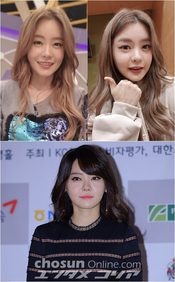 バセドウ病眼症が治った ソ ユリが整形疑惑を否定 Chosun Online 朝鮮日報