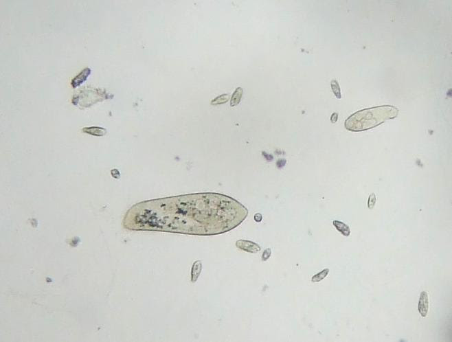 ゾウリムシを増やすには メダカのたんじょう おもしろ理科 Preparation Assistant For Scientific Experiments And Observations
