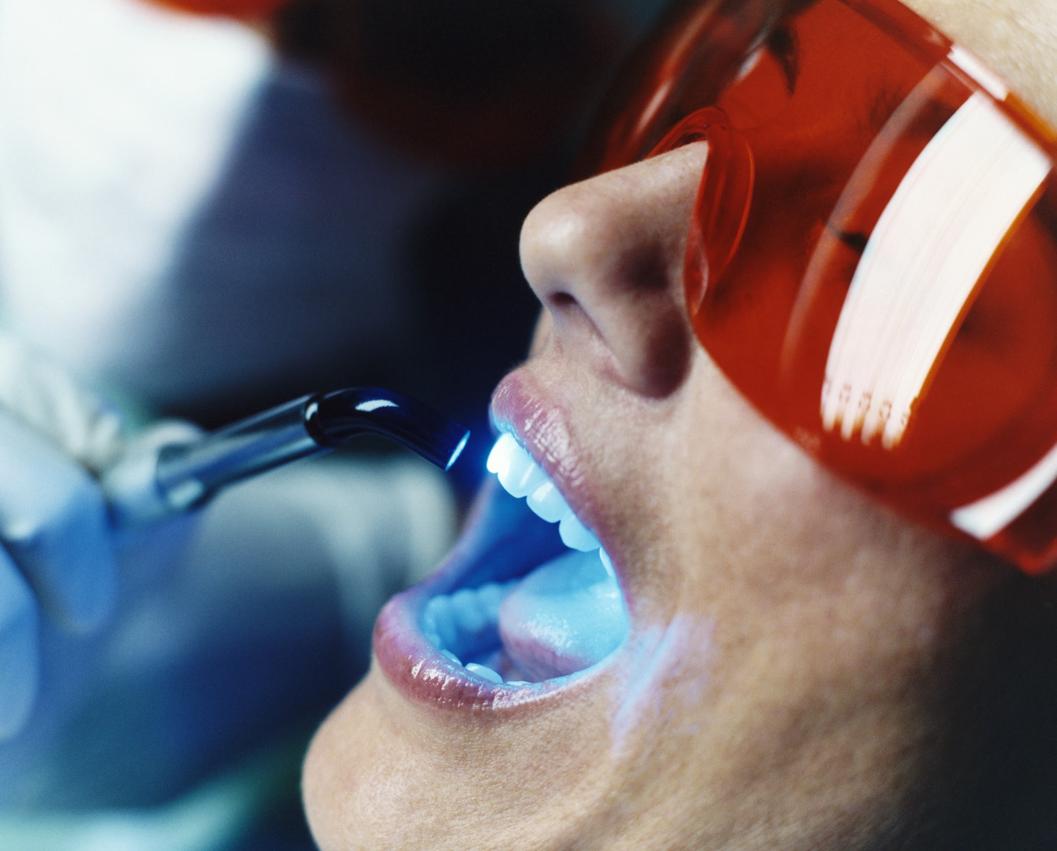 Toothaches: Causes, Treatments, and Prevention