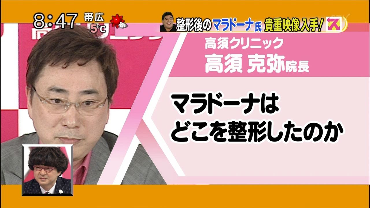 画像 美容整形手術で美しくなった元アルゼンチン代表マラドーナ氏 54 をご覧ください ２ｃｈみんなのまとめ