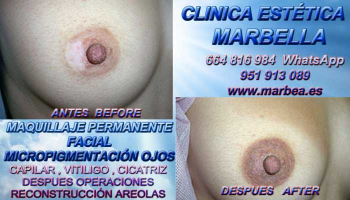 cicatrices mamoplastia de aumento Tratamiento cicatrices después de reduccion MAMARIA en Marbella y Algeciras. Maquillaje Semipermanente Marbella y Algeciras. Maquillaje Semipermanente Marbella y Algeciras