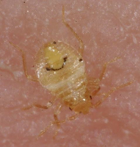 ... wrong? [expert photo ID needed] Â« Got Bed Bugs? Bedbugger Forums