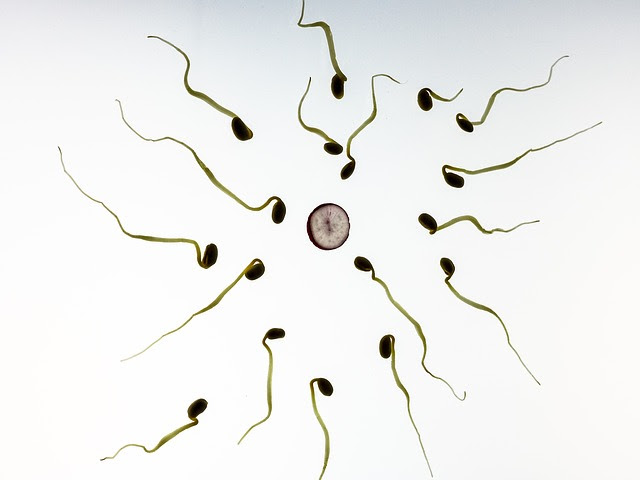 Esperienza Di Aborto Spontaneo E Perdite Di Sangue In