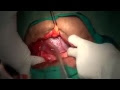  Kayfiyat wilada ~ wilada tabi3iya video