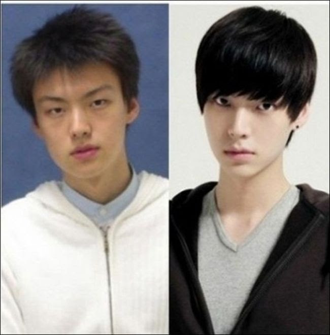 Korean Plastic Surgery (31 pics)