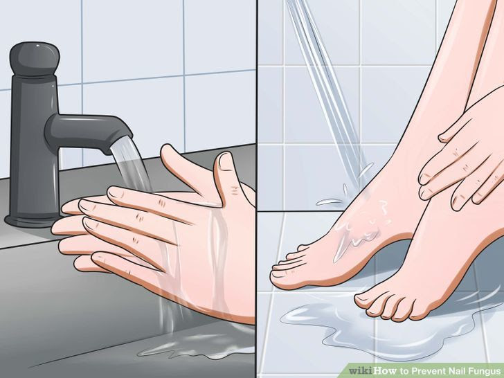 Prevent Nail Fungus Step 1.jpg