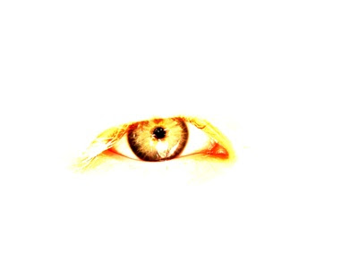 blood vessels in eye. fatty deposits under. High