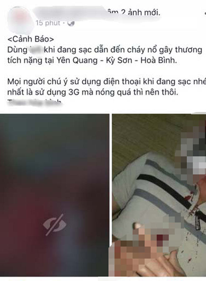Xác minh thông tin điện thoại phát nổ khiến thanh niên rách cổ - 1