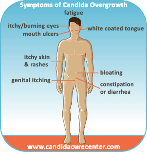 Symptoms of Candida Albicans Overgrowth  Candida Cure Center