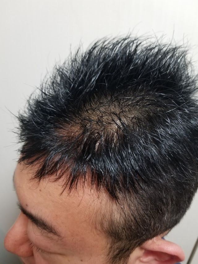 ダンディヘアー 東京都の男性用激安かつら ウィッグ専門店