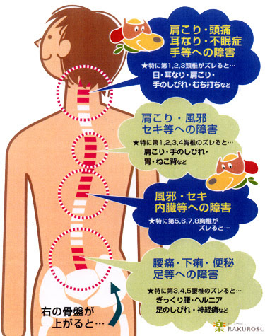 カイロプラクティック クリニカルカイロ ラクロス