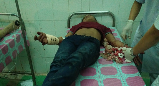 Đi thăm bác ruột, bị chém đứt gân tay trong đêm - 1