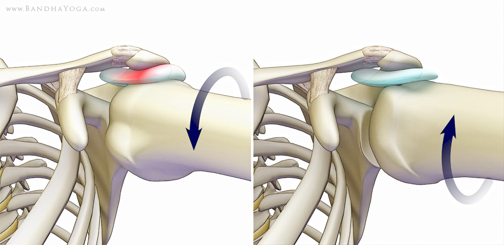 shoulder impingement