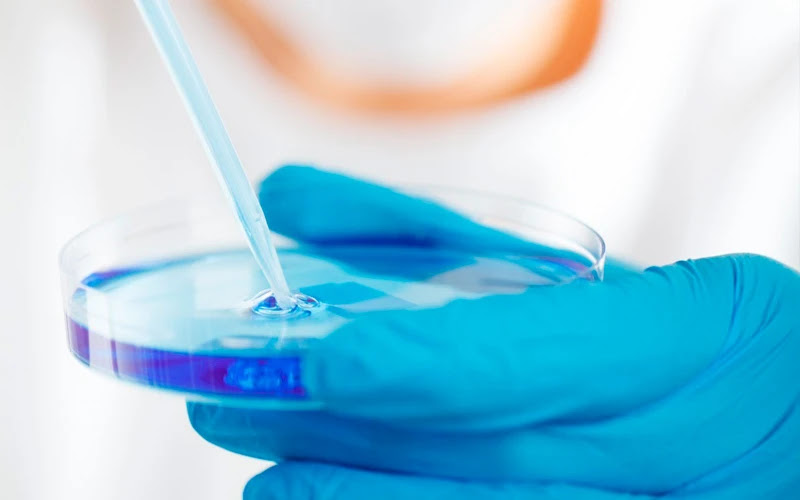 Imagen referencial. Foto: Dominio Público