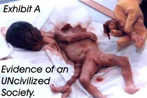 Image result for late term abortion