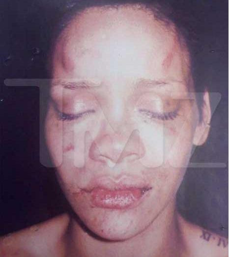 pictures of rihanna beat up. Rihanna+eat+up+2011