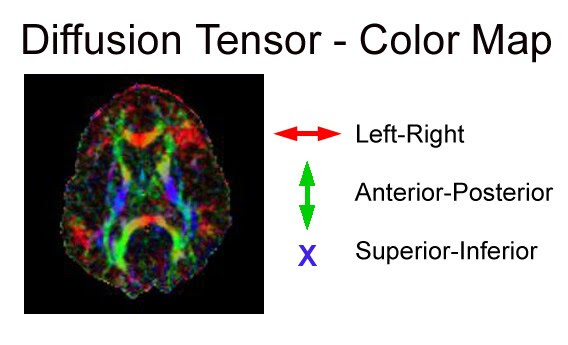axional diffusion injury