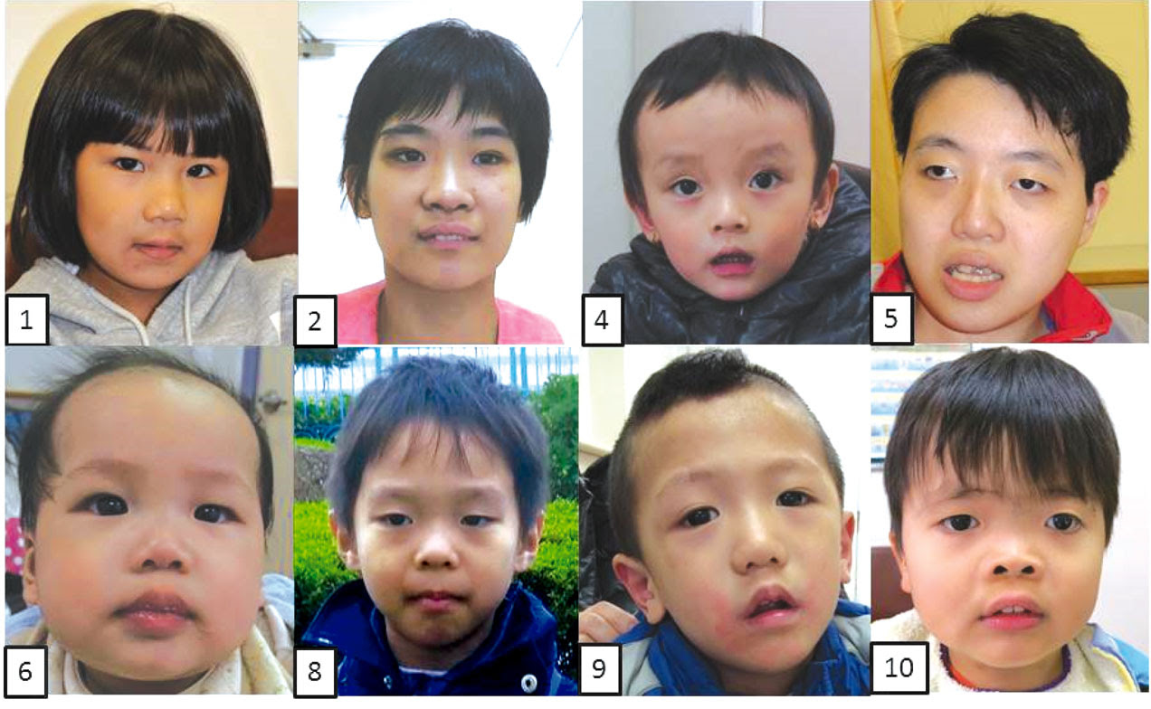 Hong Kong Journal Of Paediatrics Hk J Paediatr New Series 2018 23 173 178