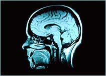 http://www.bbc.co.uk/science/humanbody/images/mind/ocd/morescience_ocd/more_brain_scan.jpg
