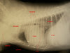 √100以上 radio thorax chat 349142-Radio thorax chat normal