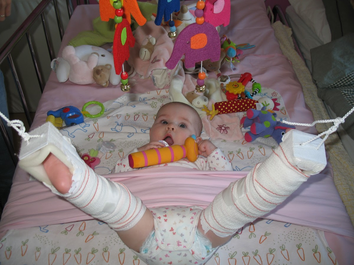 Notre Vie Avec La Luxation Congenitale De La Hanche Les Autres Petits Luxes