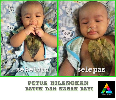petua hilangkan batuk dan selsema bayi