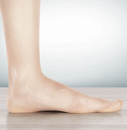 Plantar fasciitis can cause intens. Arch Types - Foot.com