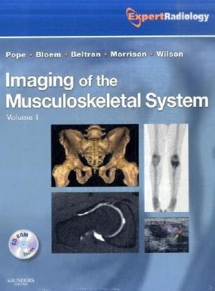 Imaging of the Musculoskeletal System, 2-Volume Set: Expert Radiology Series, 1e, by Thomas Pope MD FACR, Hans L. Bloem MD PhD, Javier B Imaging of the Musculoskeletal System, 2-Volume Set: Expert Radiology Series, 1e, by Thomas Pope MD FACR, Hans L. Bloem MD PhD, Javier B