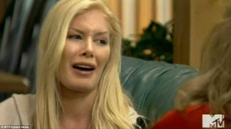 heidi montag surgery before and after. With heidi montag had ten jan