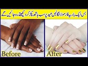 Best How To Get Instant Whiten Hands Hands Feet Skin Whitening Skin Care Tips In Urdu Hindi, most popullar!