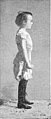 Enfant de neuf ans avec un corset abdominal type Gach-Sarraute.jpg
