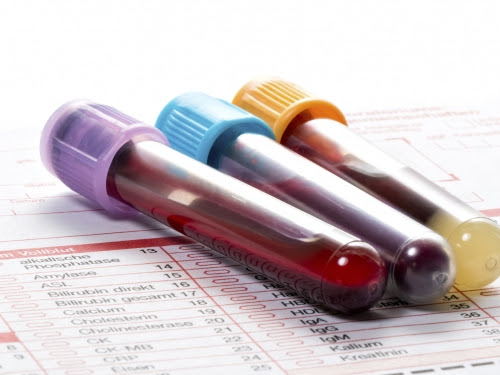 Instituto Oncofisio - Papel dos exames laboratoriais no ...