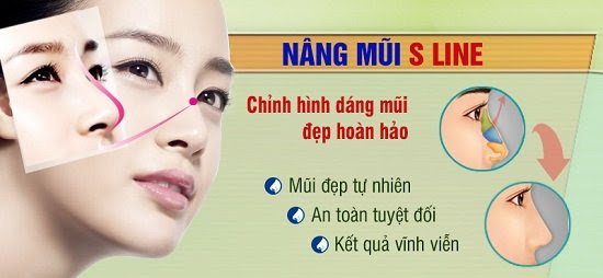 Phương pháp nâng mũi s line tạo hình bằng sụn