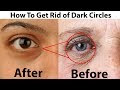 Amazing Home Remedies to Remove Dark Circles and Wrinkles Naturally in J...
