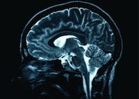 brain