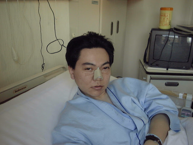 Nashuaの顔面骨折