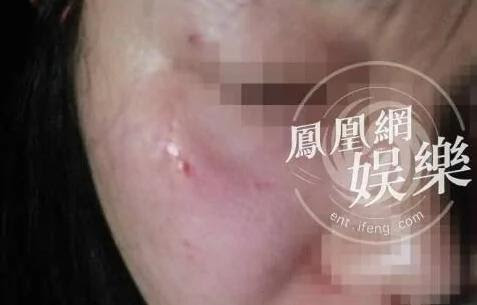 被打女攝影師