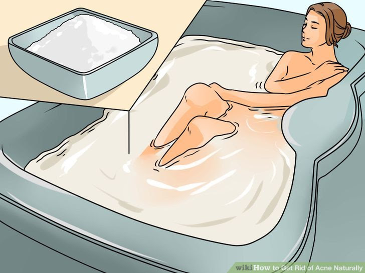 Get Rid of Acne Naturally Step 20 Version 2.jpg