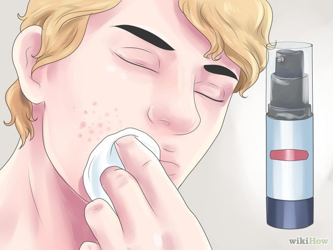 Get Rid of Acne Step 13 Version 2.jpg
