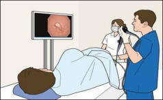 大腸内視鏡検査とは 公式 Ohc Homepage