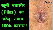 health solutions pueblo इस प्रयोग से करें बवासीर का खात्मा ! How to Cure Piles ! By NatureGuru