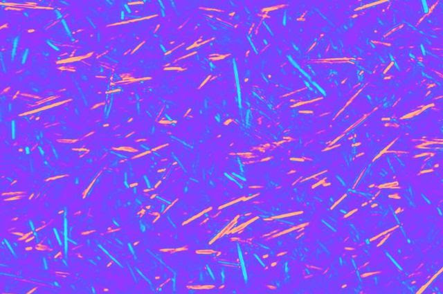Uric acid crystals
