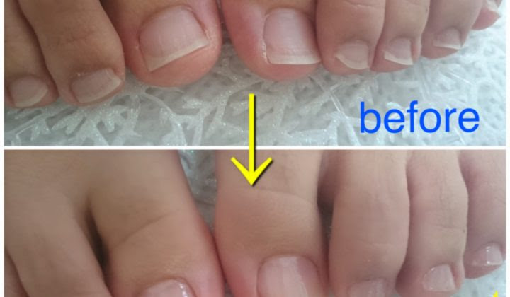 足の爪 足裏のガサガサがキレイに Soah Nail そあネイル 岐阜県神戸町 女性の為のネイルサロン
