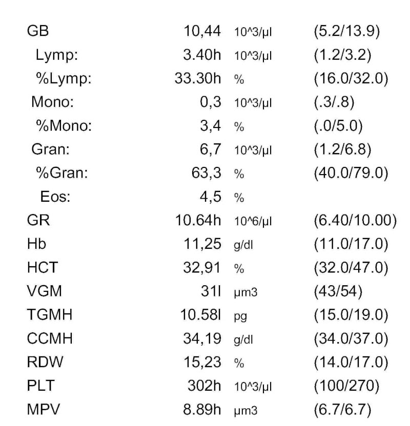 Analyse nfs c'est quoi - Terrain a batir
