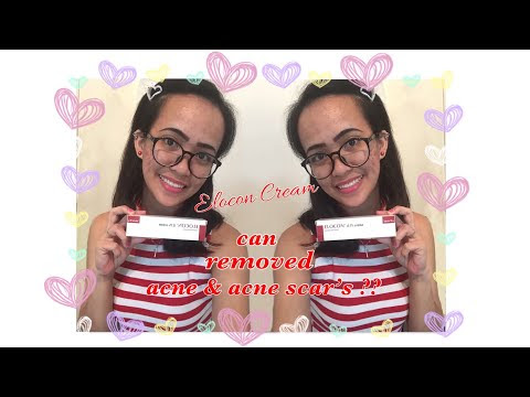 View 10 Elocon Cream Nz