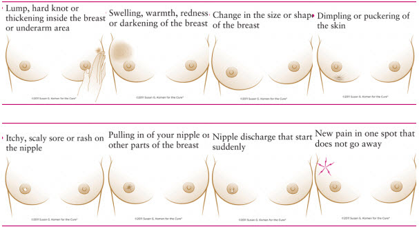 How To Know That You Have Breast Cancer | MedicineBTG.com