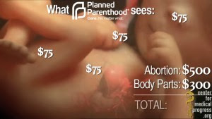 The Great American Holocaust just reach new lows in depravity through the sale of fetal body parts and organs.